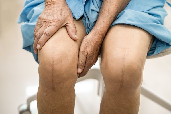Chirurgie orthopédique à Paris : soins pour hanche et genou